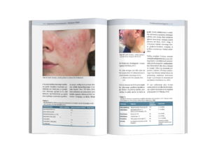 Podręcznik Problemy dermatologiczne