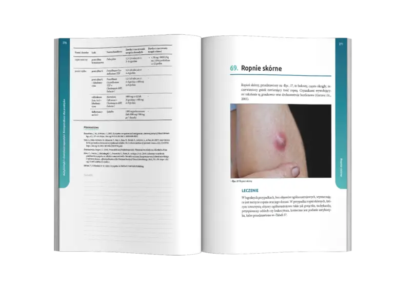 Antybiotyki i chemioterapeutyki