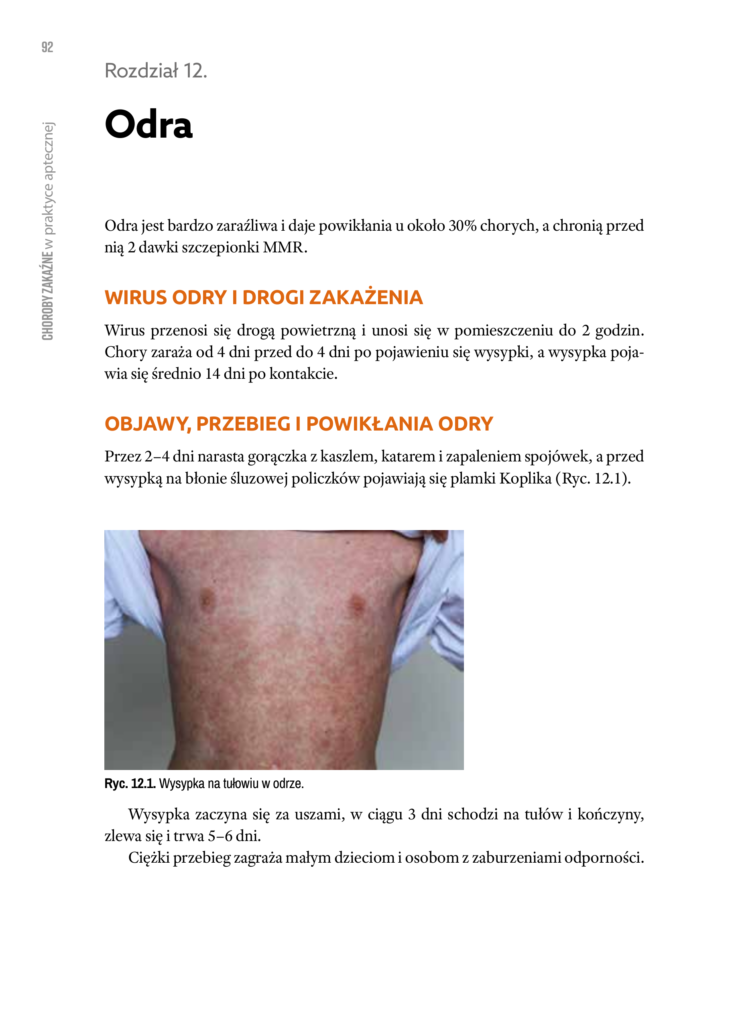 Rozdział o odrze. Ten sam układ powtarza się w każdym z 27 rozdziałów o chorobach.